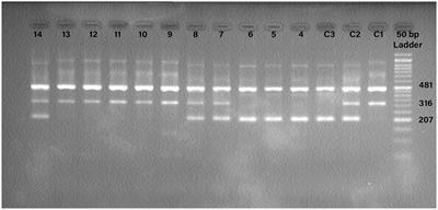 Association between TMPRSS2 rs2070788 polymorphism and COVID-19 severity: a case-control study in multiple cities of Iran